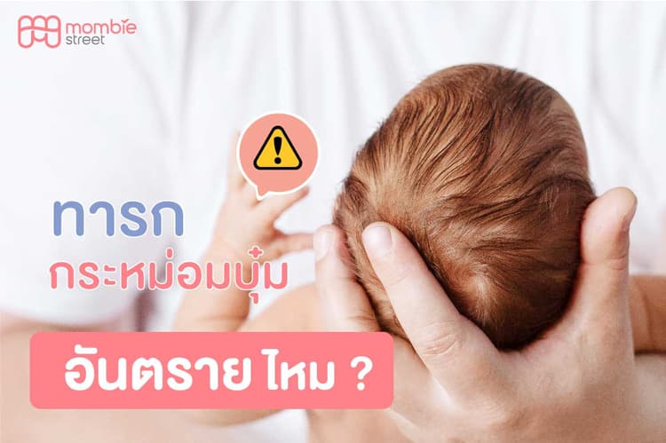 ทารกกระหม่อมบุ๋มอันตรายไหม?